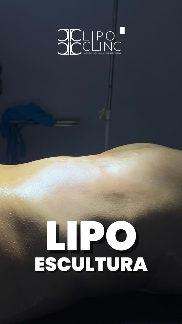 RESULTADOS REALES LIPO
